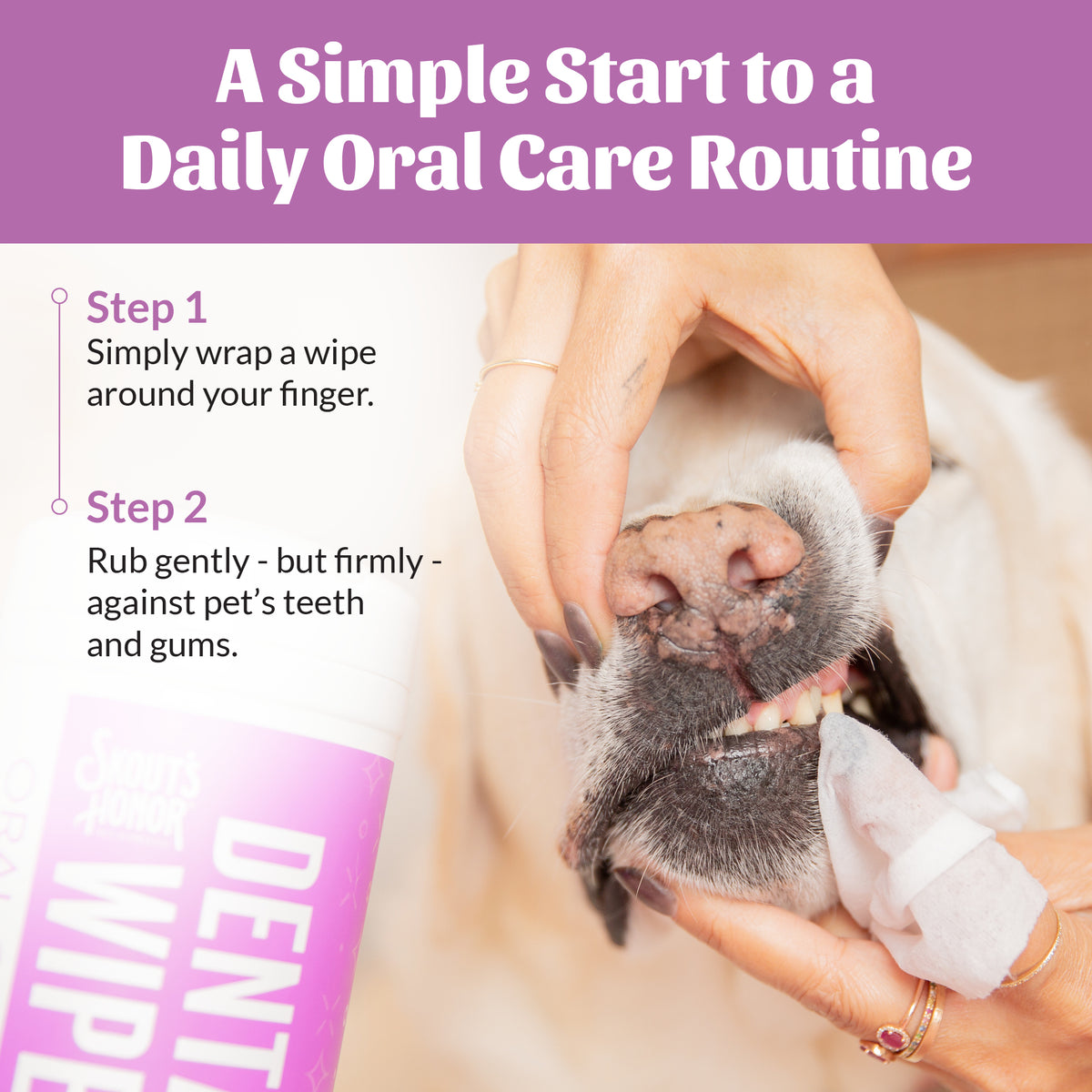 Dental Wipes