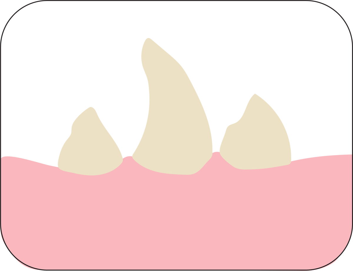 steps@3.png__PID:cc631dba-24cf-4350-809c-8c395cba085b
