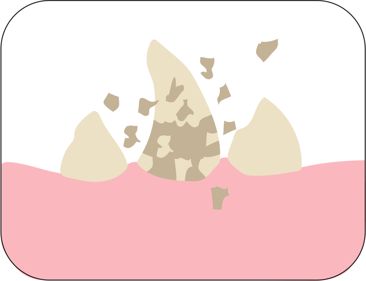 steps@4x.png__PID:647a0c1a-9433-4d18-86cd-cbecf2f7d4ce